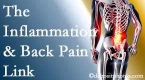 Hollstrom & Associates Inc tackles the inflammatory process that accompanies back pain as well as the pain itself.