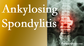 Ankylosing spondylitis is gently cared for by your Largo chiropractor.