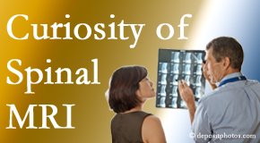 Largo MRIs for spinal stenosis may be revealing…or confusing.