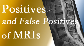 Hollstrom & Associates Inc carefully chooses when and if MRI images are needed to guide the Largo chiropractic treatment plan. 