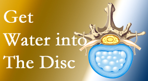 Hollstrom & Associates Inc uses spinal manipulation and exercise to boost the diffusion of water into the disc which helps the health of the disc.