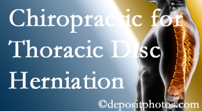 Hollstrom & Associates Inc diagnoses and manages thoracic disc herniation pain and relieves its symptoms like unexplained abdominal pain or other gastrointestinal issues. 