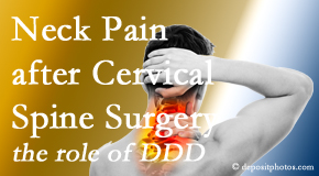 Hollstrom & Associates Inc offers gentle treatment for neck pain after neck surgery.
