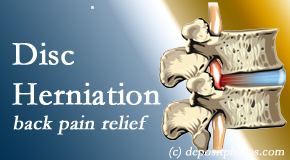 Hollstrom & Associates Inc uses non-surgical treatment for relief of disc herniation related back pain. 