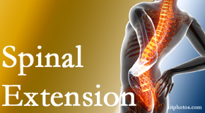Hollstrom & Associates Inc knows the role of extension in spinal motion, its necessity, its benefits and potential harmful effects. 