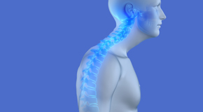 relief of Largo kyphosis pain