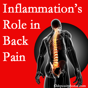 The role of inflammation in Largo back pain is real. Chiropractic care can help.