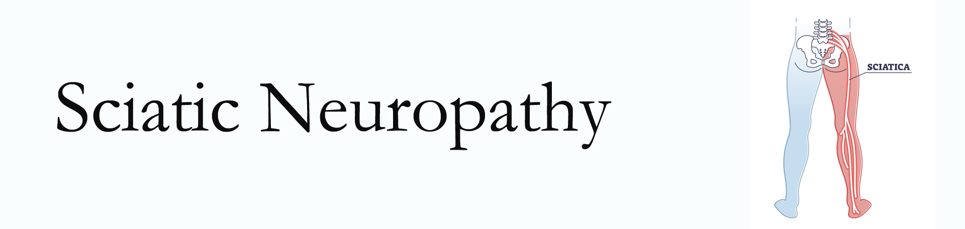 Largo neuropathy pain (sciatica)