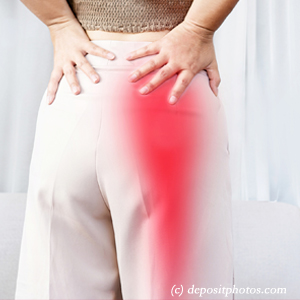 image of Largo leg pain, sciatica, lumbar radiculopathy