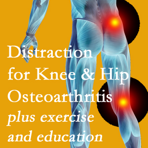 A chiropractic treatment plan for Largo knee pain and hip pain caused by osteoarthritis: education, exercise, distraction.