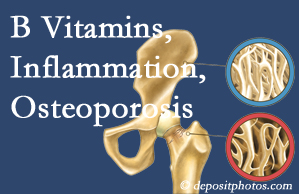Largo chiropractic care of osteoporosis usually comes with nutritional tips like b vitamins for inflammation reduction and for prevention.