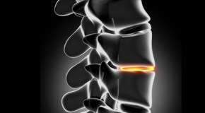 Largo chiropractic nutrition with vitamin D and quercitrin