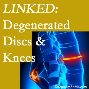 Degenerated discs and degenerated knees are not such strange bedfellows. They are seen to be related. Largo patients with a loss of disc height due to disc degeneration often also have knee pain related to degeneration.  