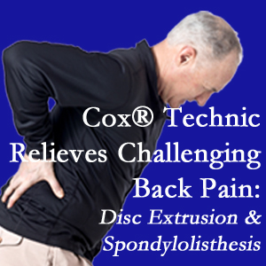 Largo chiropractic care with Cox Technic alleviates back pain due to a painful combination of a disc extrusion and a spondylolytic spondylolisthesis.