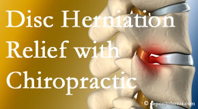 Hollstrom & Associates Inc gently treats the disc herniation causing back pain. 
